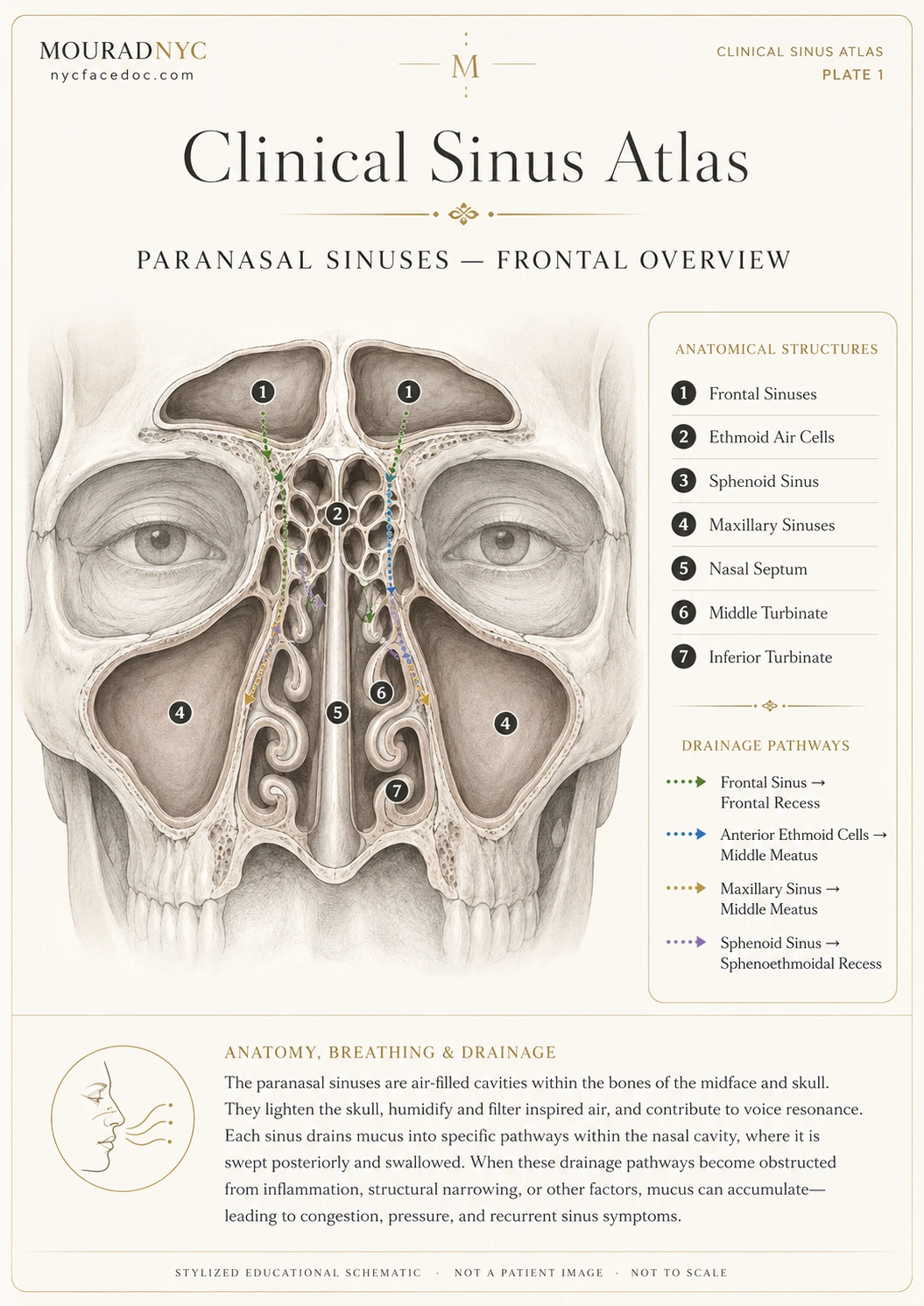 Clinical sinus atlas plate showing a frontal overview of the paranasal sinuses, nasal septum, turbinates, and major drainage pathways.