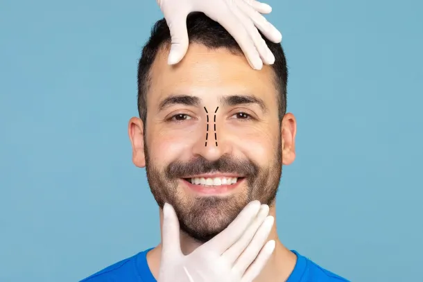 Rhinoplasty Risks and Complications: What’s Realistic, What’s Rare — Transparency Builds Trust