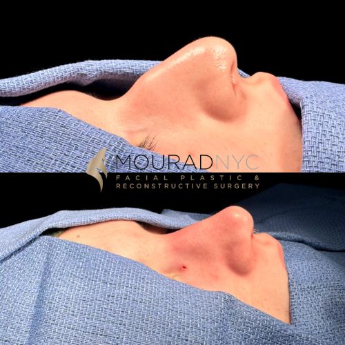 On Table Before & After