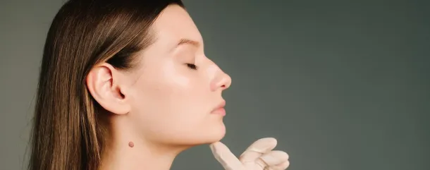 Revision Rhinoplasty: Why Some Patients Need a Second Nose Job and What to Ask — Less Common but High Value