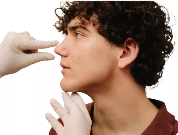 Male Rhinoplasty