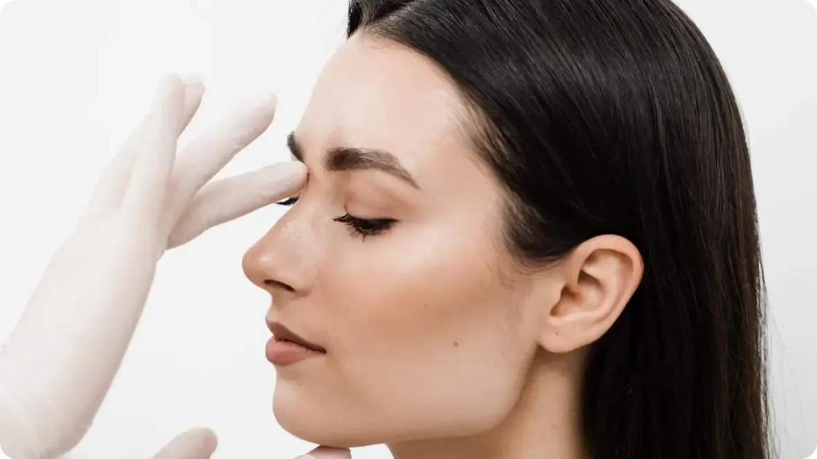 Rhinoplasty surgery treatment