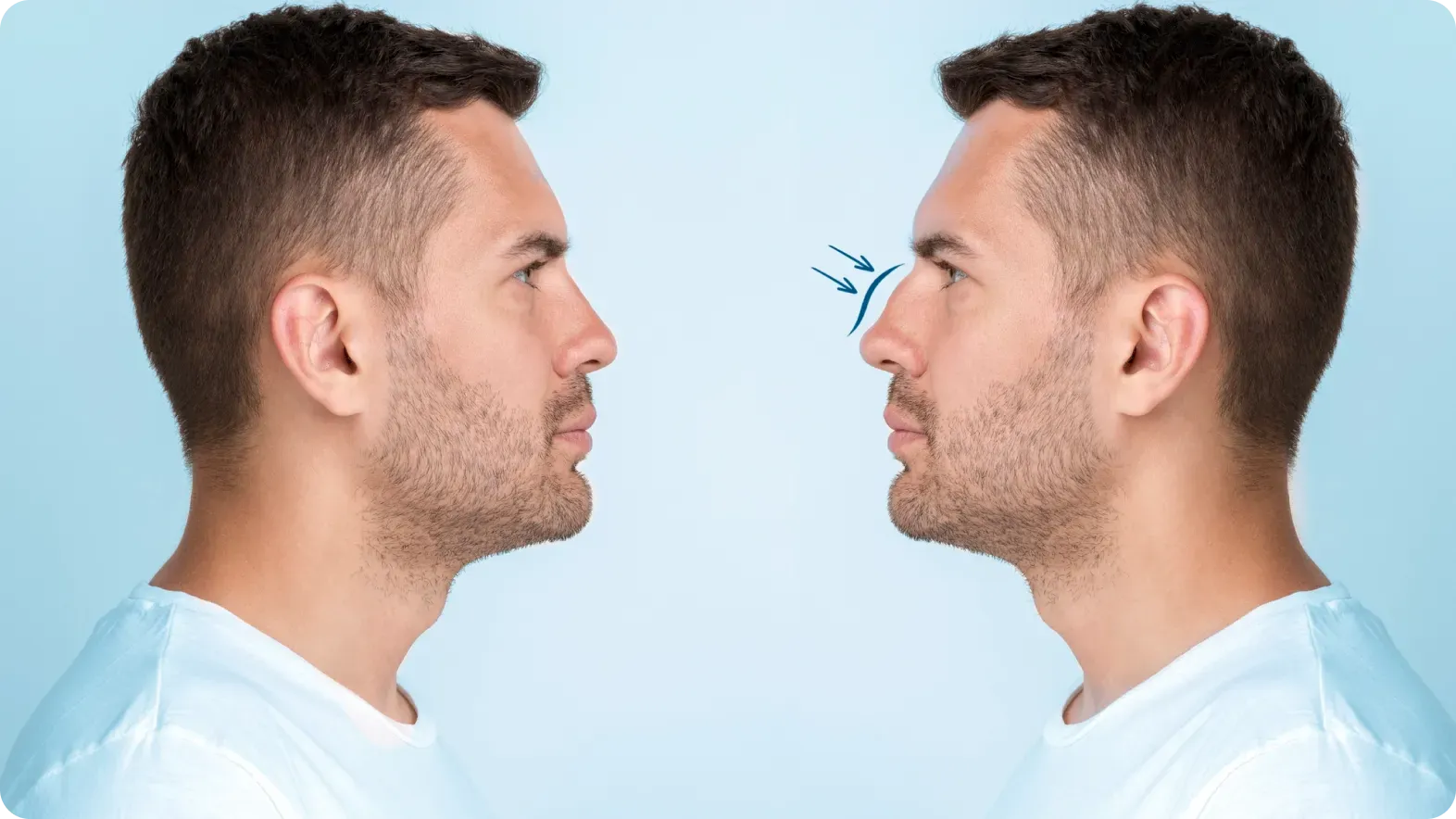 Cartilage Architecture