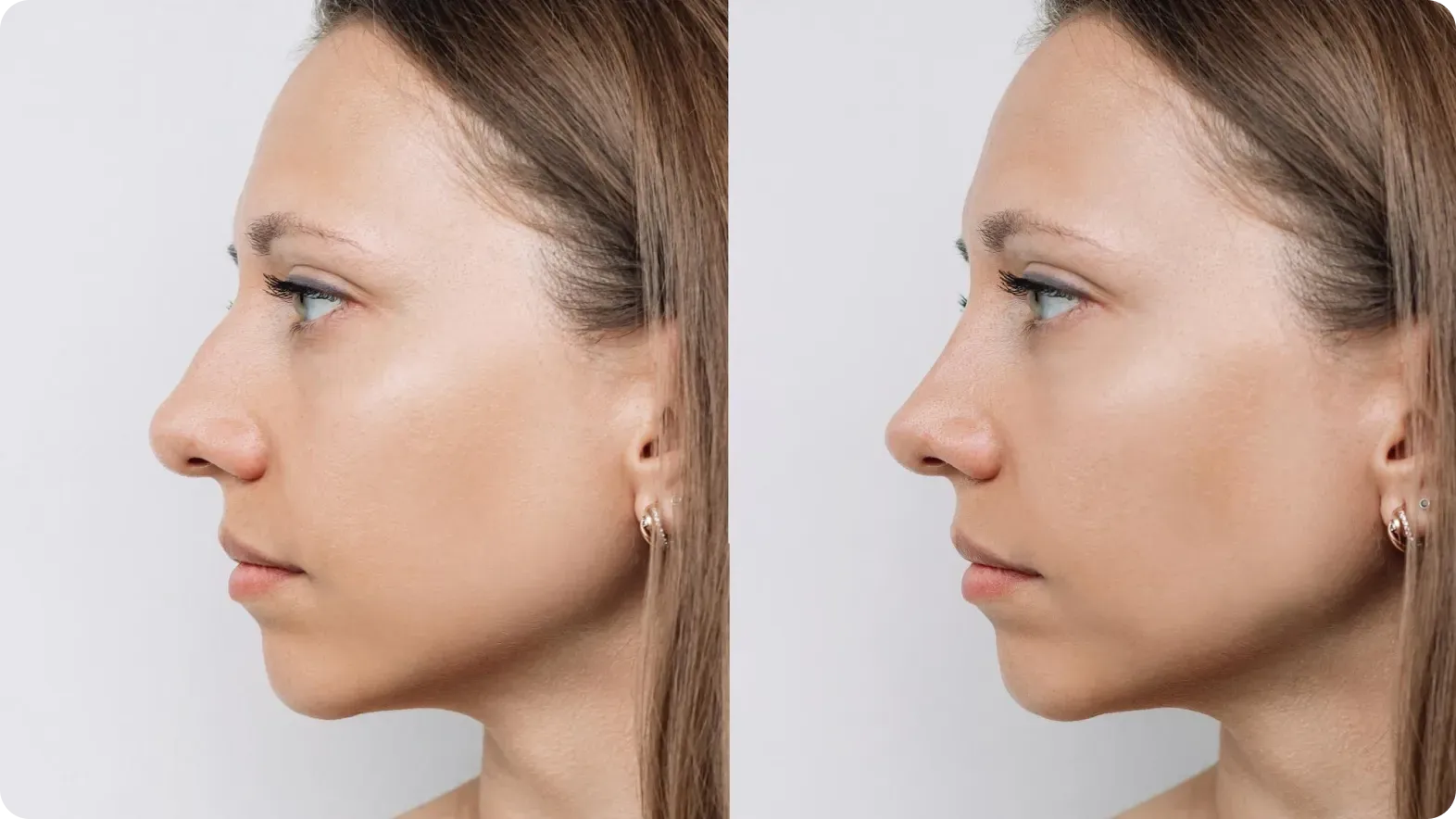 Tax-advantaged strategies