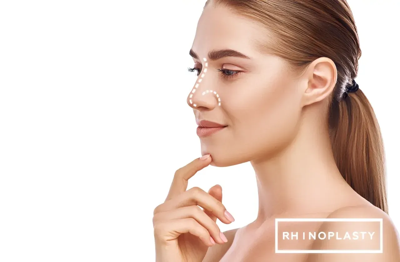 Rhinoplasty image