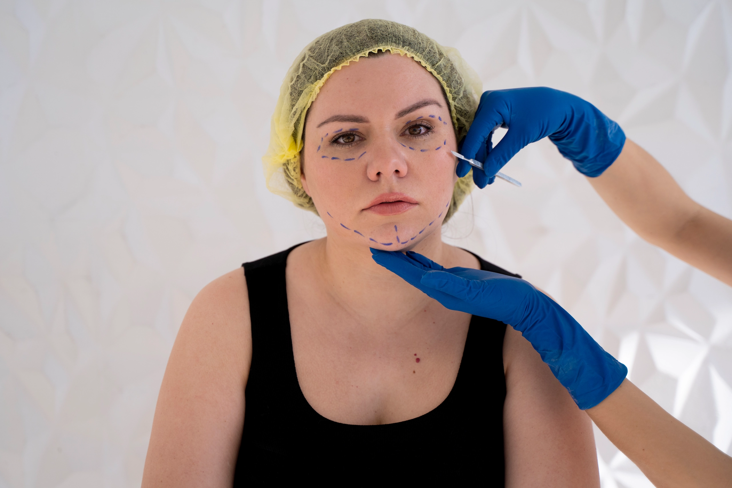 The Evolution of Rhinoplasty: From Ancient Practices to Modern Techniques