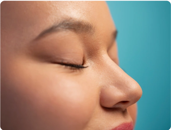 Revision Rhinoplasty