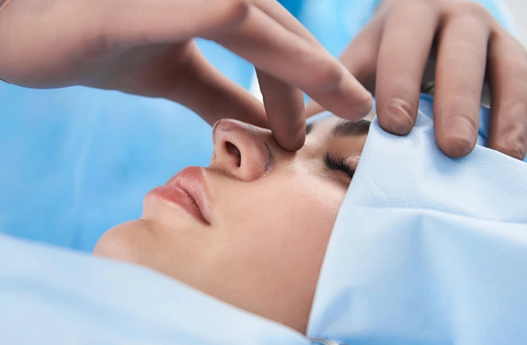 Rhinoplasty
