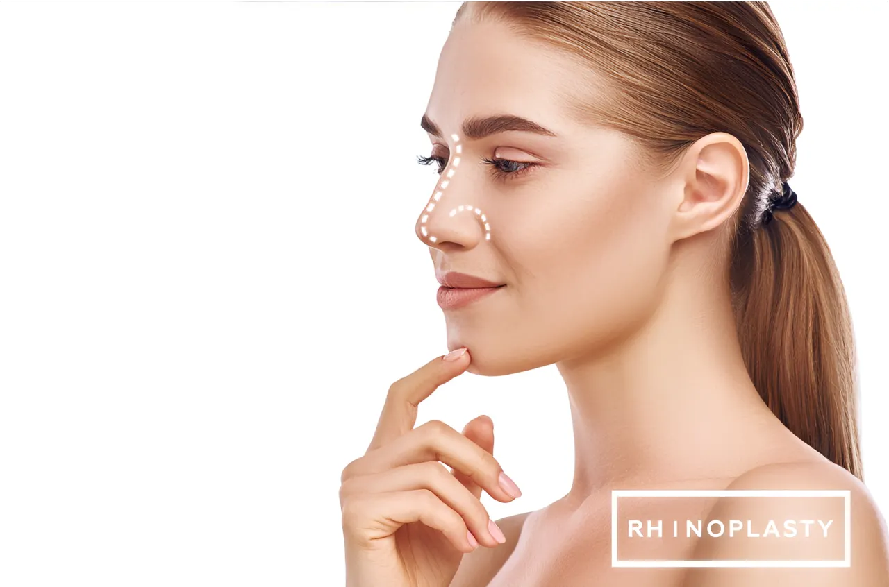 Rhinoplasty image