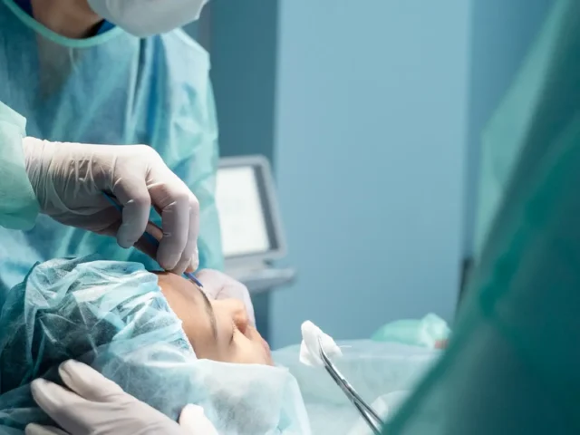 What Age Is Appropriate for Rhinoplasty? Teen Patients and Adults — Evidence-Based, Age-Related Considerations