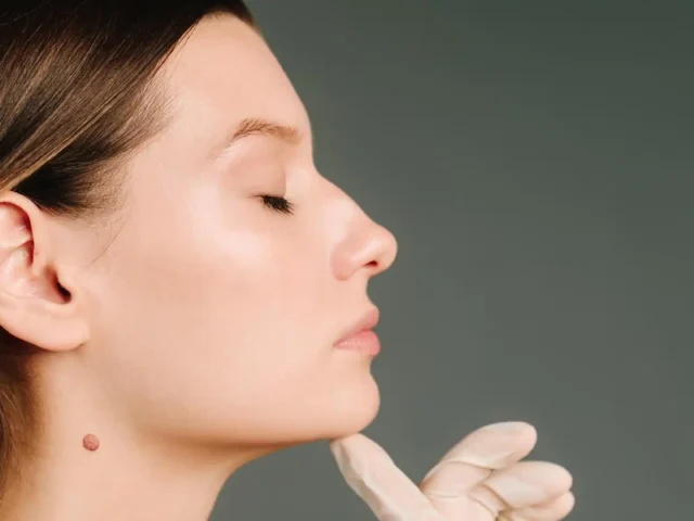 Revision Rhinoplasty: Why Some Patients Need a Second Nose Job and What to Ask — Less Common but High Value