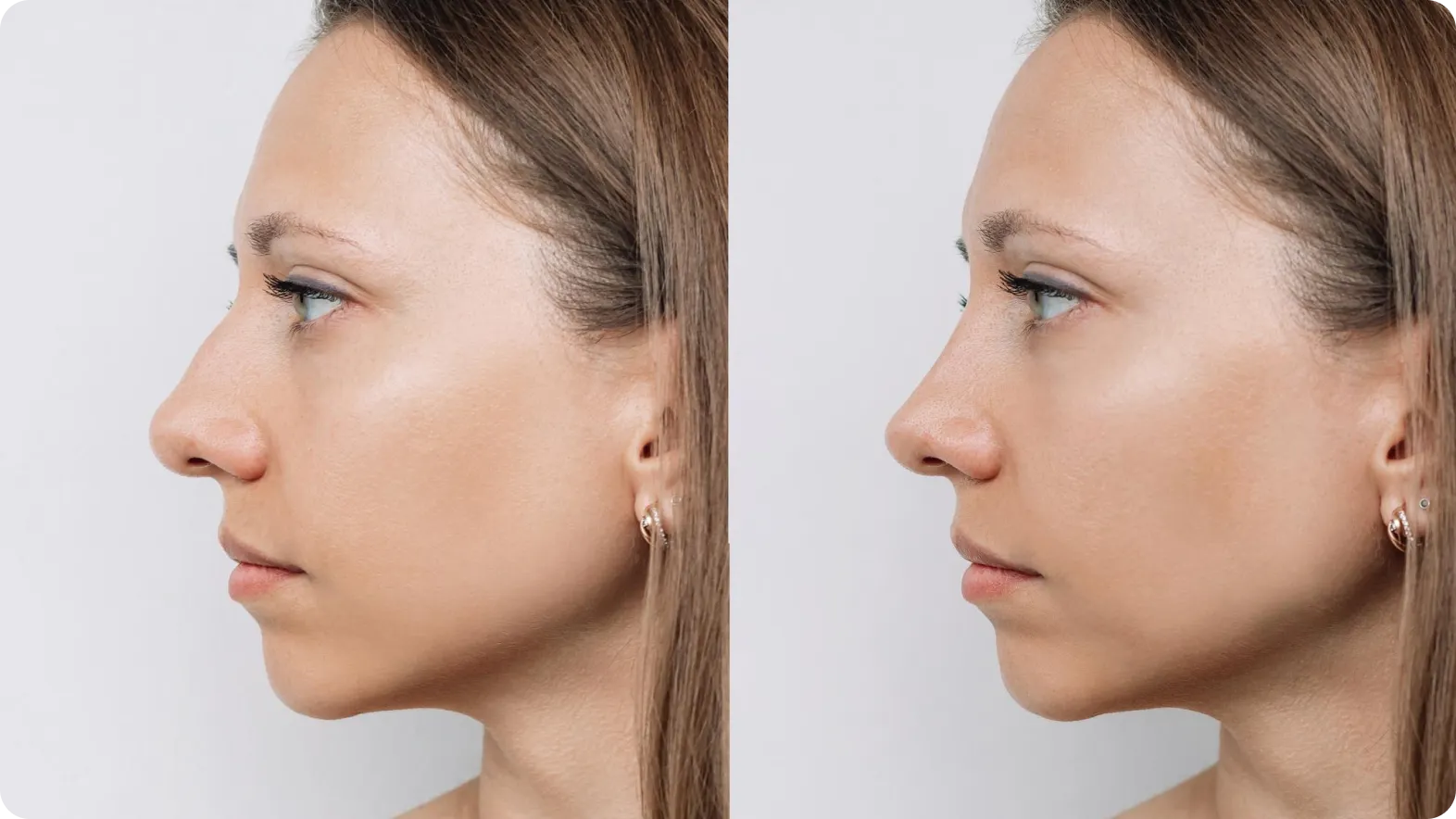 Tax-advantaged strategies