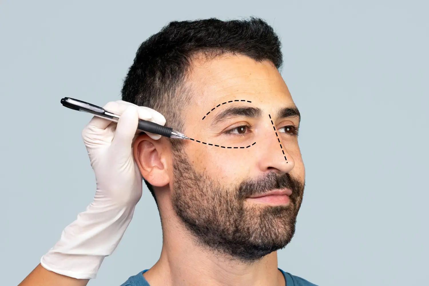 Emerging Trends in Facelift