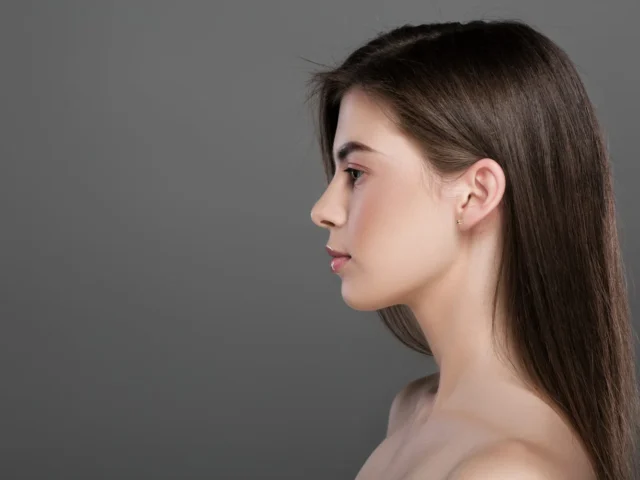 Facelift Scars: Where They Hide and How They Fade Over Time