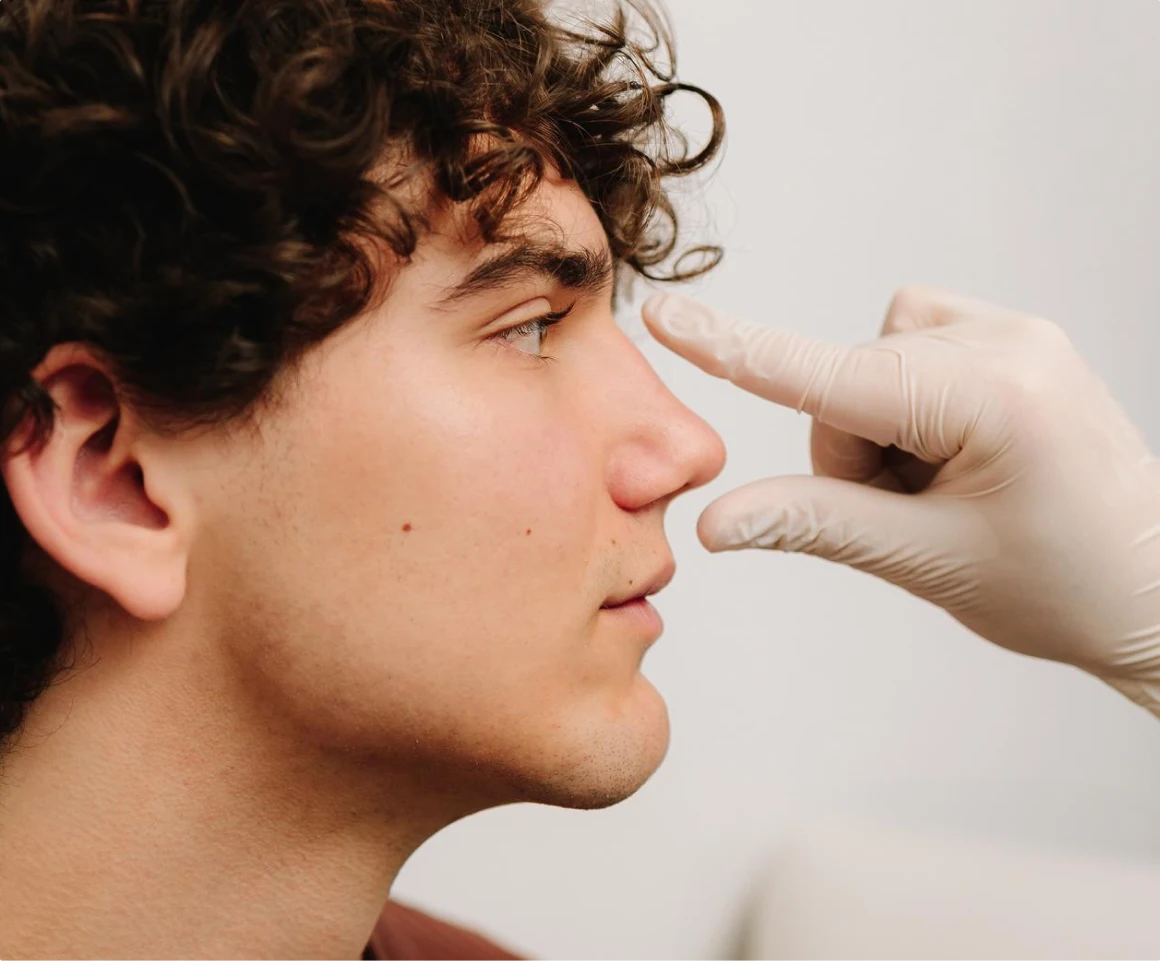 Preservation Rhinoplasty Is Not Widely Offered