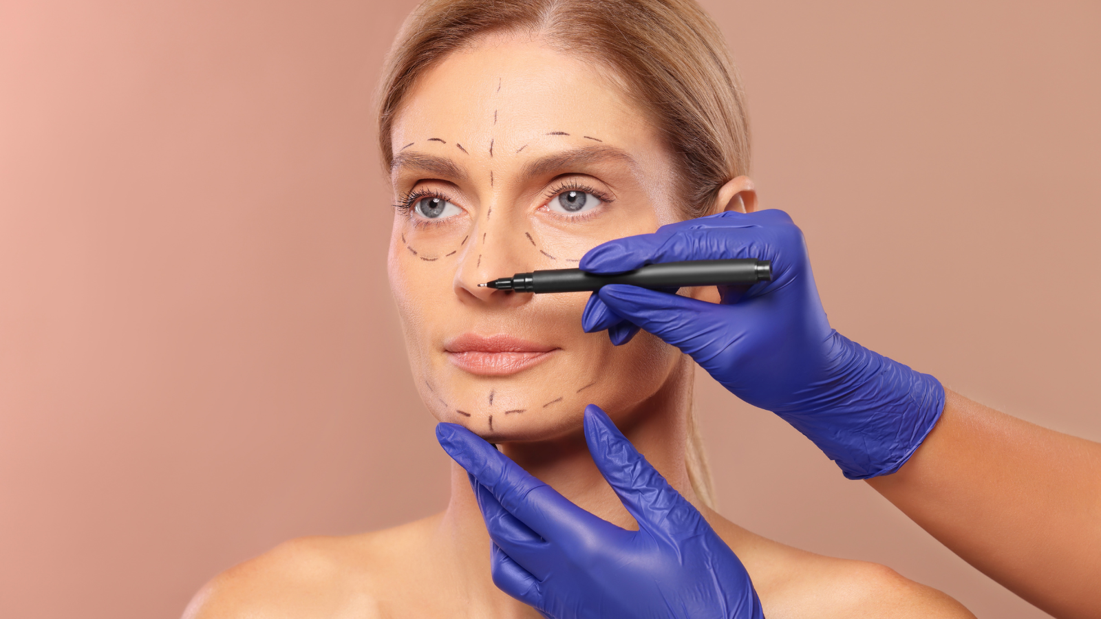 Rhinoplasty Surgery NYC