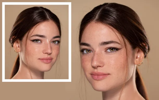 Rhinoplasty and Age: Is There a Perfect Time for a Nose Job?