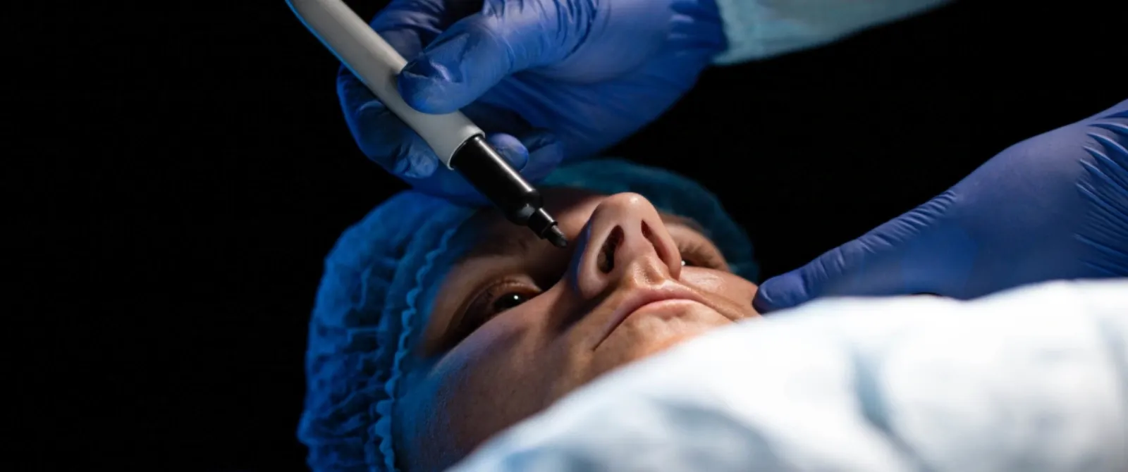 Septoplasty surgery nyc