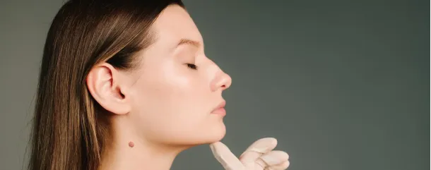 Revision Rhinoplasty: Why Some Patients Need a Second Nose Job and What to Ask — Less Common but High Value